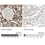 PLCL1 Antibody