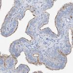 MAGI1 Antibody in Immunohistochemistry (IHC)