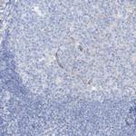 MAGI1 Antibody in Immunohistochemistry (IHC)