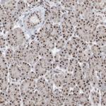 SF3A3 Antibody in Immunohistochemistry (IHC)