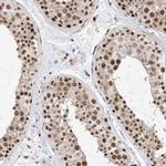 SF3A3 Antibody in Immunohistochemistry (IHC)