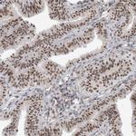 SF3A3 Antibody in Immunohistochemistry (IHC)