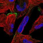 ORP6 Antibody in Immunocytochemistry (ICC/IF)