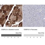 ORP6 Antibody in Immunohistochemistry (IHC)