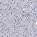 ORP6 Antibody in Immunohistochemistry (IHC)