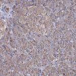 PEX13 Antibody in Immunohistochemistry (IHC)