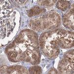 PEX13 Antibody in Immunohistochemistry (IHC)