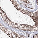 PEX13 Antibody in Immunohistochemistry (IHC)