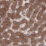 PEX13 Antibody in Immunohistochemistry (IHC)