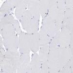 PTPRO Antibody in Immunohistochemistry (IHC)