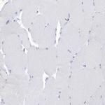 PTPRO Antibody in Immunohistochemistry (IHC)