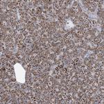 SAMM50 Antibody in Immunohistochemistry (IHC)