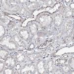 MAN1A2 Antibody in Immunohistochemistry (IHC)