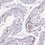 PKDREJ Antibody in Immunohistochemistry (IHC)