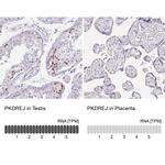 PKDREJ Antibody