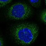 NEDL2 Antibody in Immunocytochemistry (ICC/IF)
