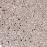 NEDL2 Antibody in Immunohistochemistry (IHC)