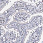 NEDL2 Antibody in Immunohistochemistry (IHC)