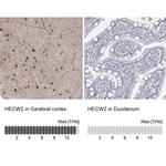 NEDL2 Antibody