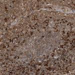 SRP72 Antibody in Immunohistochemistry (IHC)