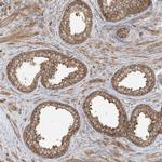 SRP72 Antibody in Immunohistochemistry (IHC)