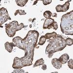 SRP72 Antibody in Immunohistochemistry (IHC)