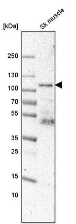 SYNPO Antibody in Western Blot (WB)