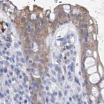 UGP2 Antibody in Immunohistochemistry (IHC)