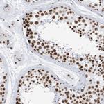 KHSRP Antibody in Immunohistochemistry (IHC)