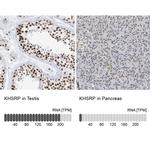 KHSRP Antibody