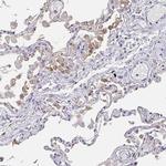 CACNA2D2 Antibody in Immunohistochemistry (IHC)