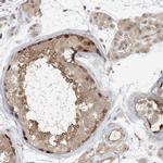 C13orf7 Antibody in Immunohistochemistry (IHC)