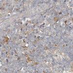 C13orf7 Antibody in Immunohistochemistry (IHC)