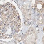 C13orf7 Antibody in Immunohistochemistry (IHC)