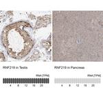 C13orf7 Antibody