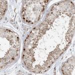 C13orf7 Antibody in Immunohistochemistry (IHC)