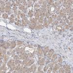 C13orf7 Antibody in Immunohistochemistry (IHC)