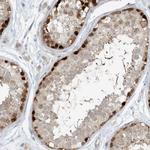 C13orf7 Antibody in Immunohistochemistry (IHC)