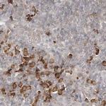 C13orf7 Antibody in Immunohistochemistry (IHC)