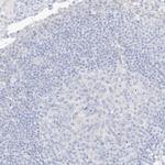 XIRP2 Antibody in Immunohistochemistry (IHC)