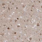 GTPBP8 Antibody in Immunohistochemistry (IHC)