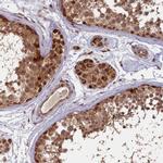 SHPRH Antibody in Immunohistochemistry (IHC)