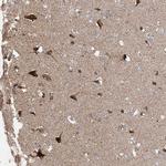 UQCC1 Antibody in Immunohistochemistry (IHC)