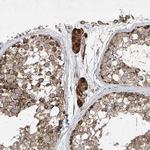 UQCC1 Antibody in Immunohistochemistry (IHC)