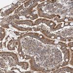 UQCC1 Antibody in Immunohistochemistry (IHC)