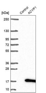 ACYP1 Antibody in Western Blot (WB)