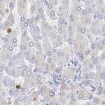 Grancalcin Antibody in Immunohistochemistry (IHC)