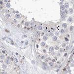 MPP10 Antibody in Immunohistochemistry (IHC)