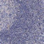 MPP10 Antibody in Immunohistochemistry (IHC)