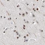 MPP10 Antibody in Immunohistochemistry (IHC)